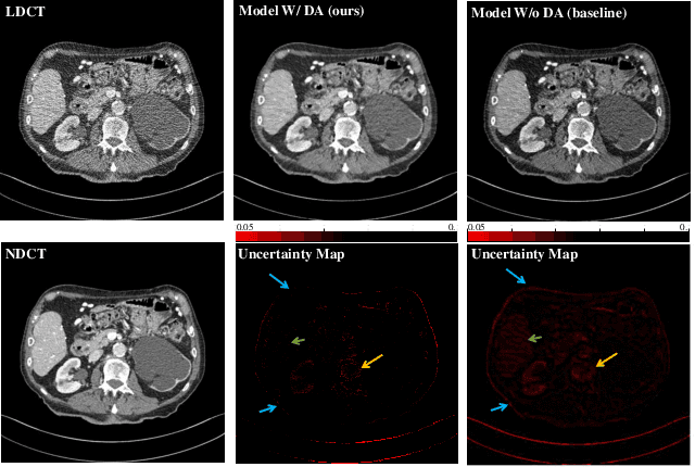Figure 2 for Robust Cross-domain CT Image Reconstruction via Bayesian Noise Uncertainty Alignment