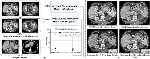 Figure 1 for Robust Cross-domain CT Image Reconstruction via Bayesian Noise Uncertainty Alignment