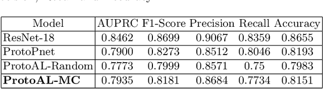 Figure 3 for ProtoAL: Interpretable Deep Active Learning with prototypes for medical imaging
