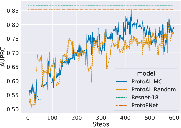 Figure 4 for ProtoAL: Interpretable Deep Active Learning with prototypes for medical imaging