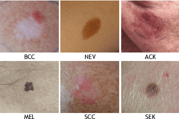 Figure 1 for Optimizing Skin Lesion Classification via Multimodal Data and Auxiliary Task Integration