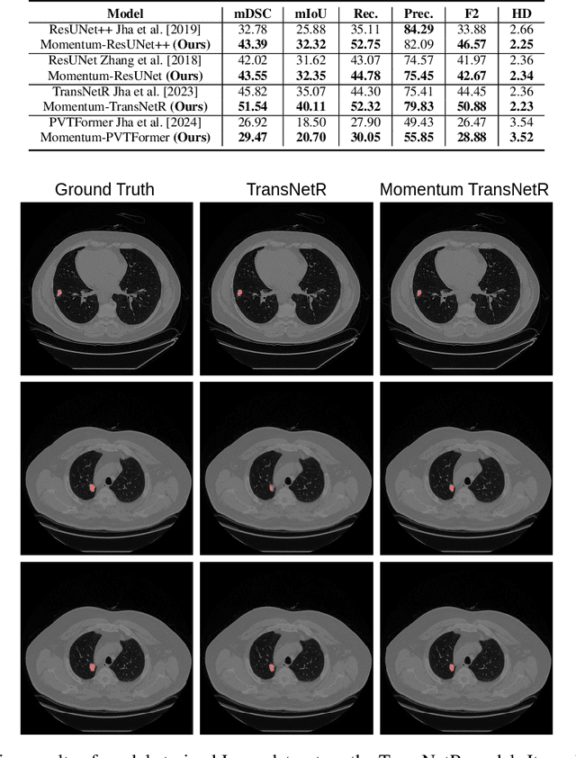 Figure 2 for A Novel Momentum-Based Deep Learning Techniques for Medical Image Classification and Segmentation