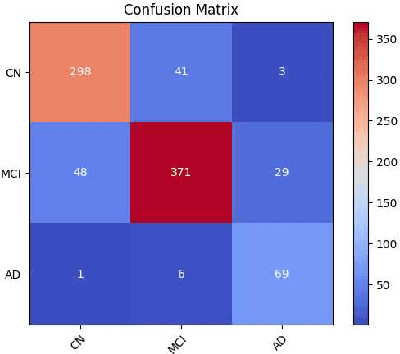Figure 3 for Multimodal Contrastive Learning and Tabular Attention for Automated Alzheimer's Disease Prediction