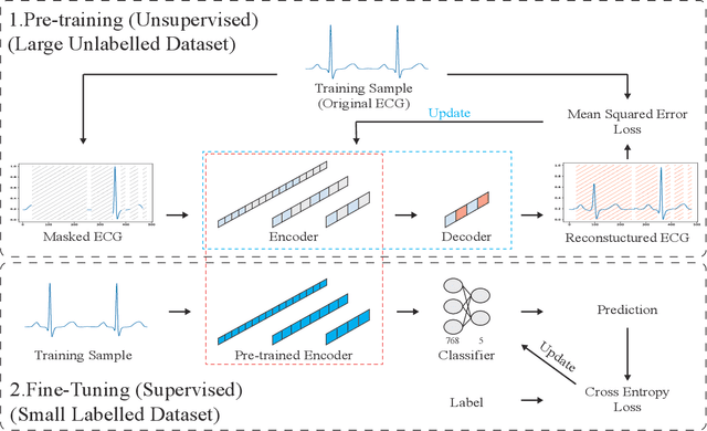 Figure 1 for Unsupervised Pre-Training Using Masked Autoencoders for ECG Analysis