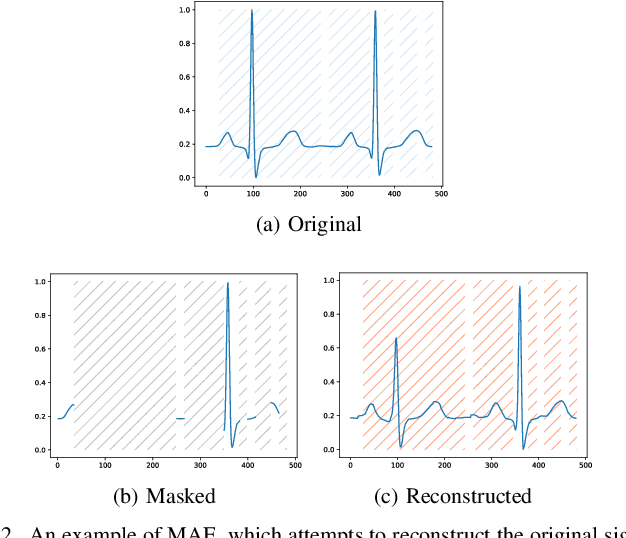 Figure 2 for Unsupervised Pre-Training Using Masked Autoencoders for ECG Analysis