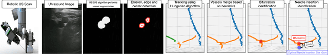Figure 2 for Bifurcation Identification for Ultrasound-driven Robotic Cannulation