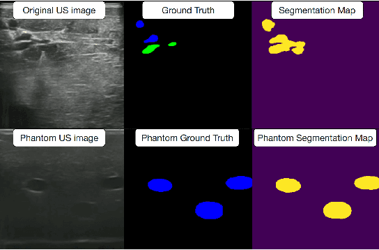 Figure 3 for Bifurcation Identification for Ultrasound-driven Robotic Cannulation