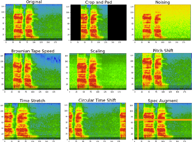 Figure 1 for Optimizing Audio Augmentations for Contrastive Learning of Health-Related Acoustic Signals