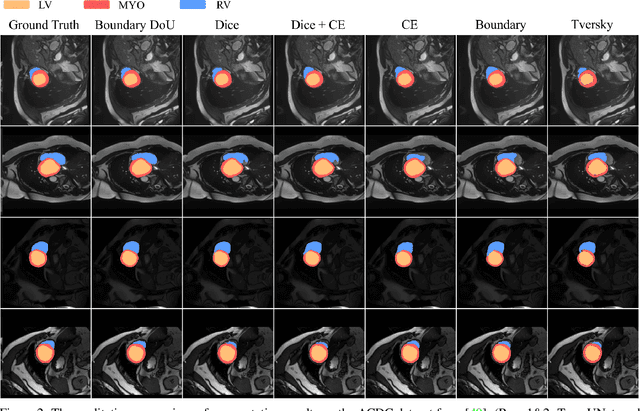 Figure 3 for Loss Functions in the Era of Semantic Segmentation: A Survey and Outlook