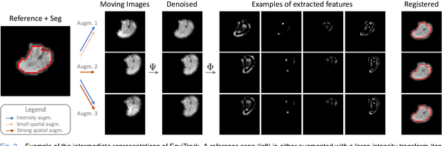 Figure 3 for SE-Equivariant and Noise-Invariant 3D Motion Tracking in Medical Images