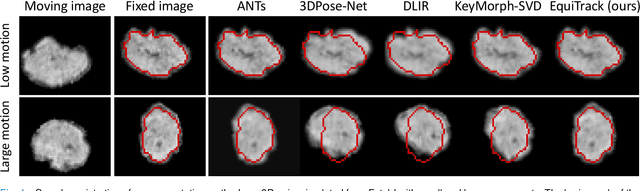 Figure 4 for SE-Equivariant and Noise-Invariant 3D Motion Tracking in Medical Images