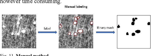Figure 3 for Advanced Image Segmentation Techniques for Neural Activity Detection via C-fos Immediate Early Gene Expression