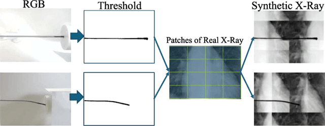 Figure 1 for H-Net: A Multitask Architecture for Simultaneous 3D Force Estimation and Stereo Semantic Segmentation in Intracardiac Catheters