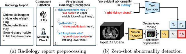 Figure 1 for CT-GLIP: 3D Grounded Language-Image Pretraining with CT Scans and Radiology Reports for Full-Body Scenarios