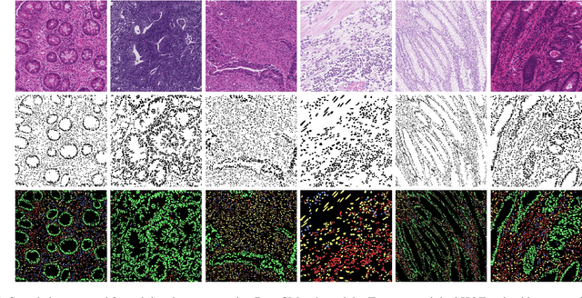 Figure 3 for Histopathological Image Classification with Cell Morphology Aware Deep Neural Networks