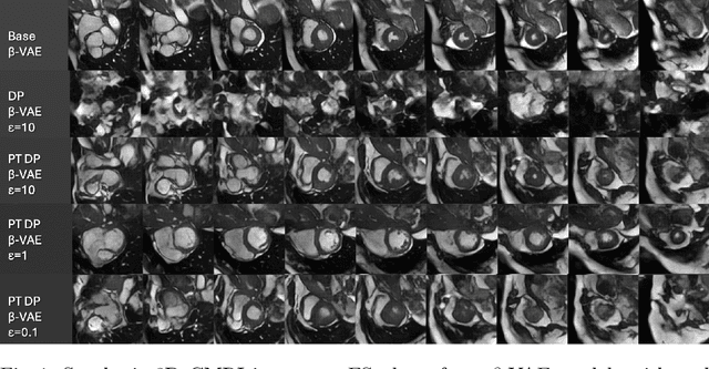 Figure 2 for On Differentially Private 3D Medical Image Synthesis with Controllable Latent Diffusion Models