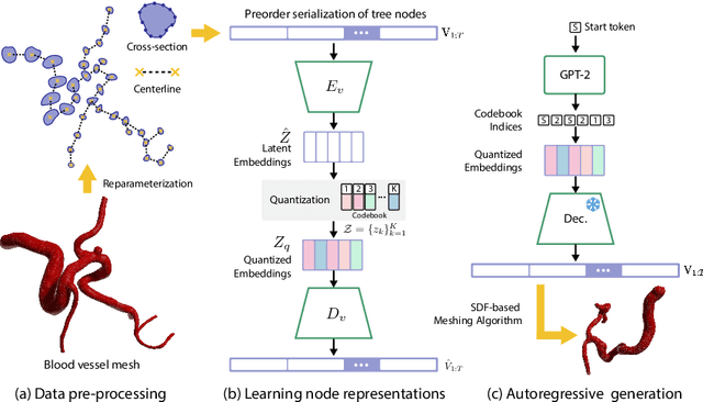 Figure 1 for VesselGPT: Autoregressive Modeling of Vascular Geometry