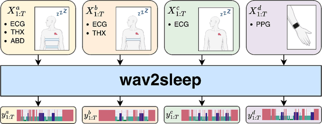 Figure 1 for wav2sleep: A Unified Multi-Modal Approach to Sleep Stage Classification from Physiological Signals