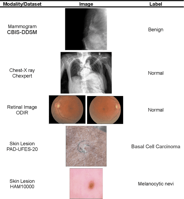 Figure 4 for Embeddings are all you need! Achieving High Performance Medical Image Classification through Training-Free Embedding Analysis