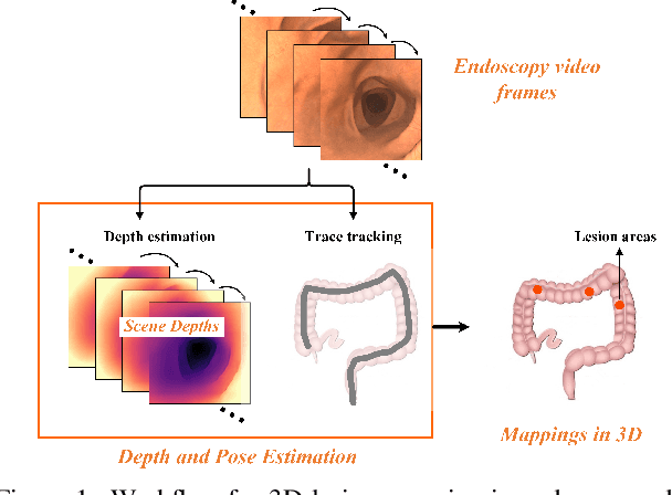 Figure 1 for Self-supervised Monocular Depth and Pose Estimation for Endoscopy with Generative Latent Priors