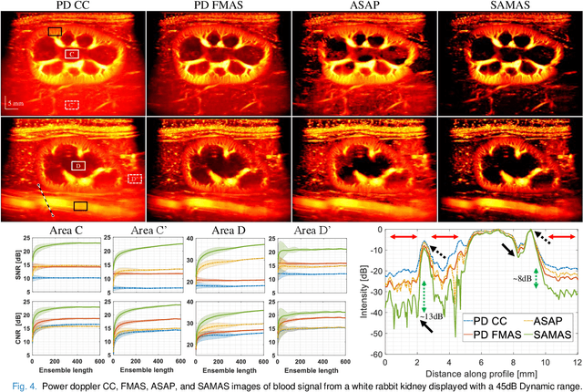 Figure 4 for Enhanced Acoustic Beamforming with Sub-Aperture Angular Multiply and Sum -- in vivo and in Human Demonstration