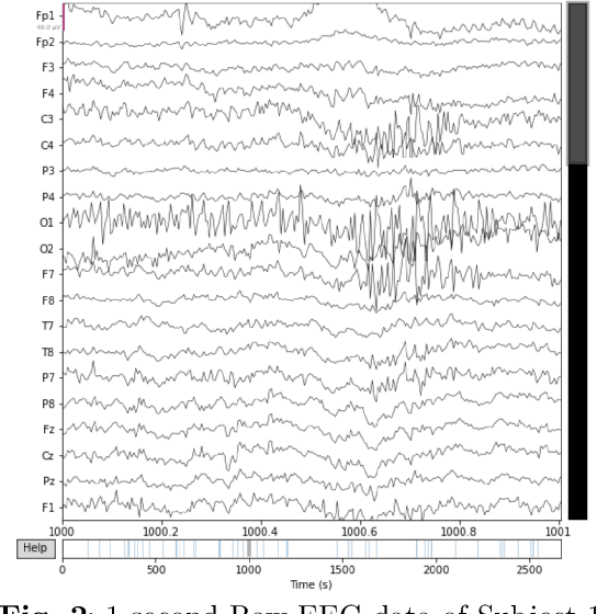 Figure 3 for Human Brain Exhibits Distinct Patterns When Listening to Fake Versus Real Audio: Preliminary Evidence