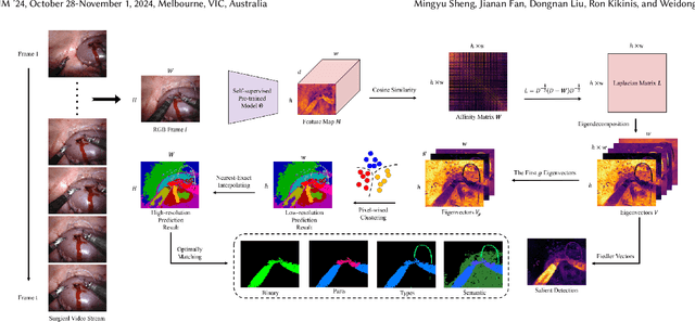 Figure 1 for Revisiting Surgical Instrument Segmentation Without Human Intervention: A Graph Partitioning View