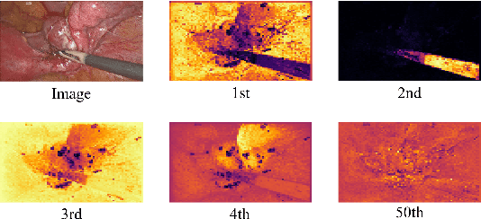 Figure 3 for Revisiting Surgical Instrument Segmentation Without Human Intervention: A Graph Partitioning View