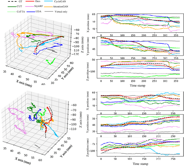 Figure 4 for Efficient Domain Adaptation for Endoscopic Visual Odometry