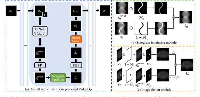 Figure 1 for Unsupervised CT Metal Artifact Reduction by Plugging Diffusion Priors in Dual Domains