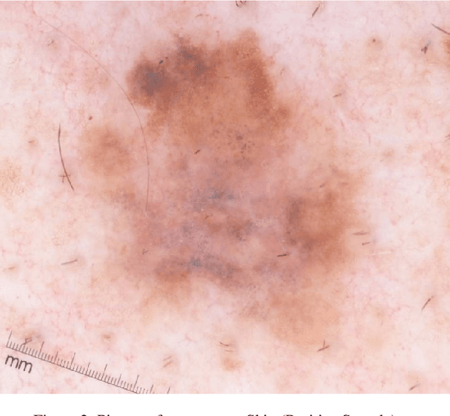 Figure 3 for A Study of Acquisition Functions for Medical Imaging Deep Active Learning