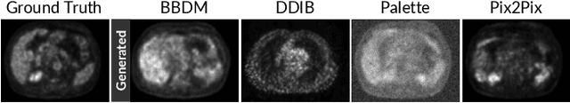 Figure 1 for CT to PET Translation: A Large-scale Dataset and Domain-Knowledge-Guided Diffusion Approach