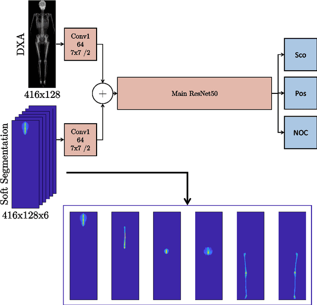 Figure 3 for Predicting Spine Geometry and Scoliosis from DXA Scans