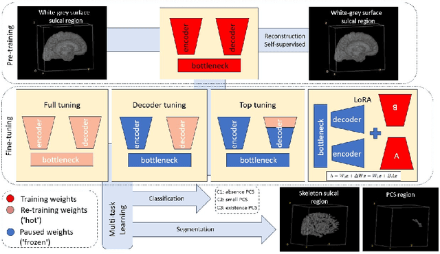 Figure 1 for Contrastive-Adversarial and Diffusion: Exploring pre-training and fine-tuning strategies for sulcal identification