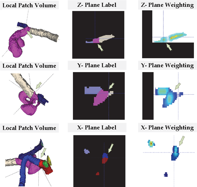 Figure 3 for Topology-Aware Exploration of Circle of Willis for CTA and MRA: Segmentation, Detection, and Classification