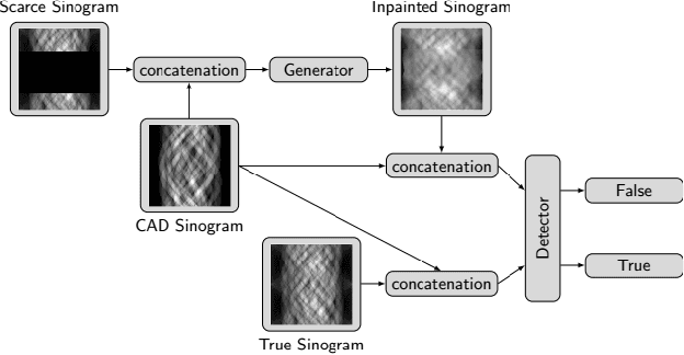Figure 2 for Sinogram Enhancement with Generative Adversarial Networks using Shape Priors