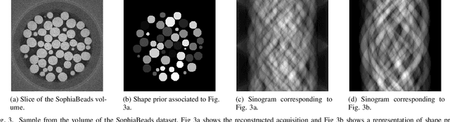 Figure 3 for Sinogram Enhancement with Generative Adversarial Networks using Shape Priors