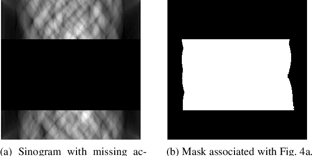 Figure 4 for Sinogram Enhancement with Generative Adversarial Networks using Shape Priors