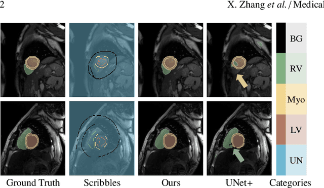 Figure 1 for HELPNet: Hierarchical Perturbations Consistency and Entropy-guided Ensemble for Scribble Supervised Medical Image Segmentation