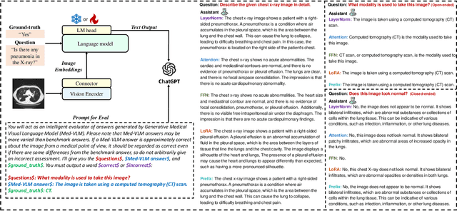 Figure 3 for Efficiency in Focus: LayerNorm as a Catalyst for Fine-tuning Medical Visual Language Pre-trained Models