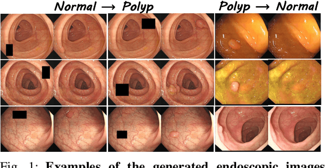 Figure 1 for Polyp-Gen: Realistic and Diverse Polyp Image Generation for Endoscopic Dataset Expansion