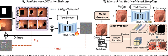 Figure 2 for Polyp-Gen: Realistic and Diverse Polyp Image Generation for Endoscopic Dataset Expansion