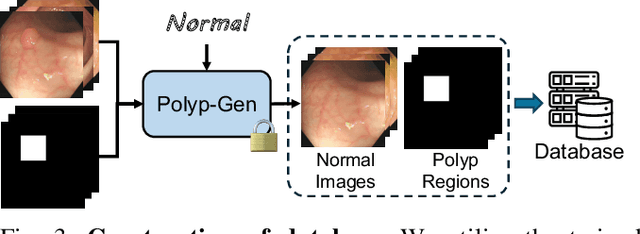 Figure 3 for Polyp-Gen: Realistic and Diverse Polyp Image Generation for Endoscopic Dataset Expansion