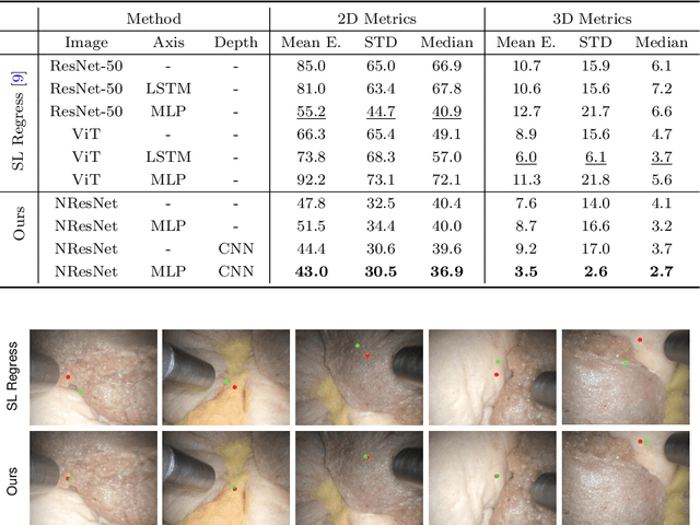 Figure 2 for Nested ResNet: A Vision-Based Method for Detecting the Sensing Area of a Drop-in Gamma Probe