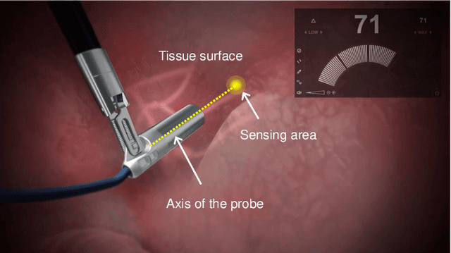 Figure 1 for Nested ResNet: A Vision-Based Method for Detecting the Sensing Area of a Drop-in Gamma Probe