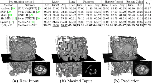 Figure 4 for HySparK: Hybrid Sparse Masking for Large Scale Medical Image Pre-Training