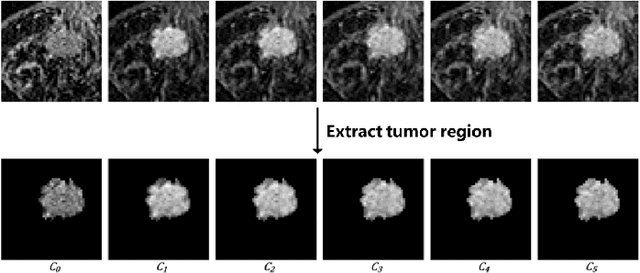 Figure 3 for Exploring Kinetic Curves Features for the Classification of Benign and Malignant Breast Lesions in DCE-MRI