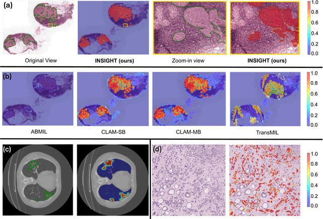 Figure 4 for INSIGHT: Explainable Weakly-Supervised Medical Image Analysis