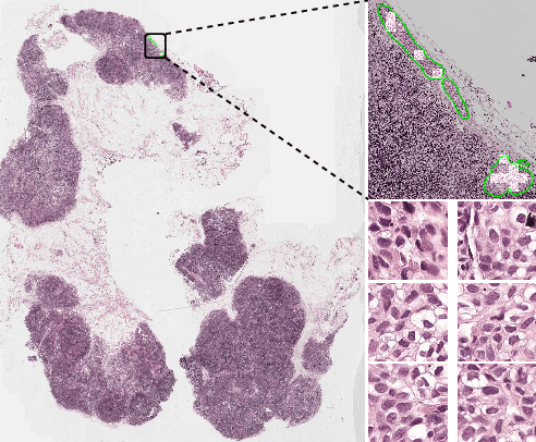 Figure 1 for Iterative Patch Selection for High-Resolution Image Recognition