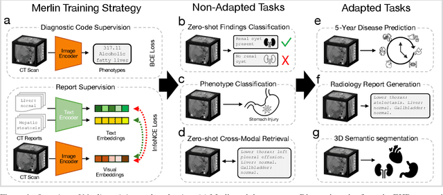 Figure 1 for Merlin: A Vision Language Foundation Model for 3D Computed Tomography